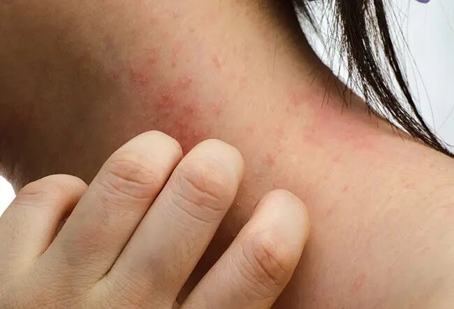 درباره دانههای پوستی و انواع آنها