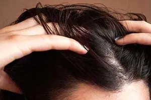 9 اشتباه که موهای شما را چرب می‌کند!