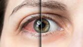 علل نابینایی چیست؟ + فیلم