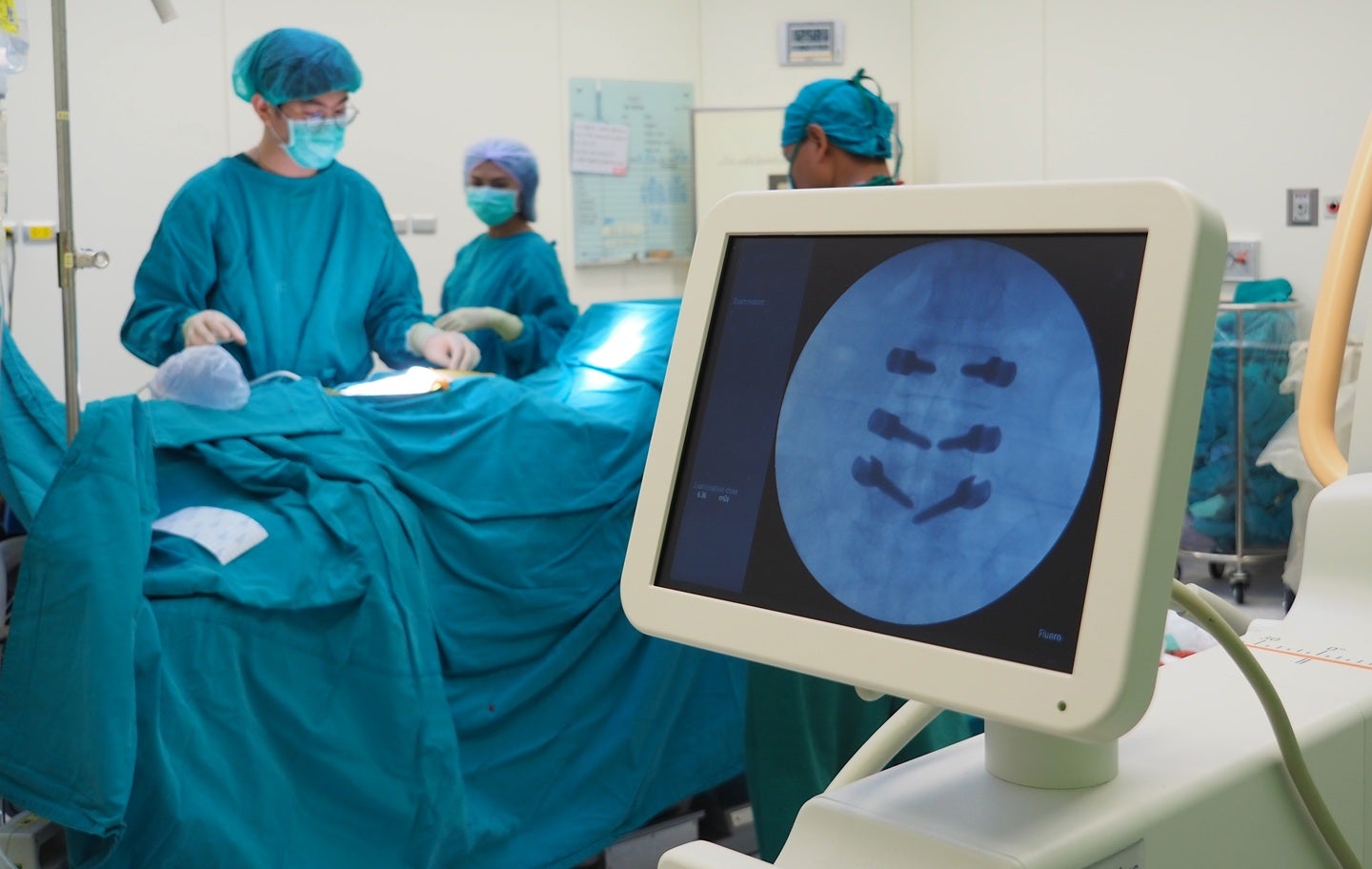 VB Spine برای کسب حقوق فناوری CT-Fluoro شرکت Augmedics
