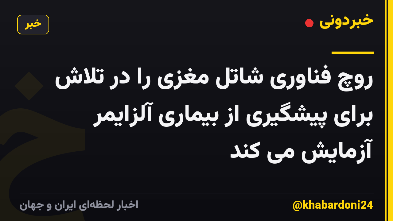 روچ فناوری شاتل مغزی را در تلاش برای پیشگیری از بیماری آلزایمر آزمایش می کند