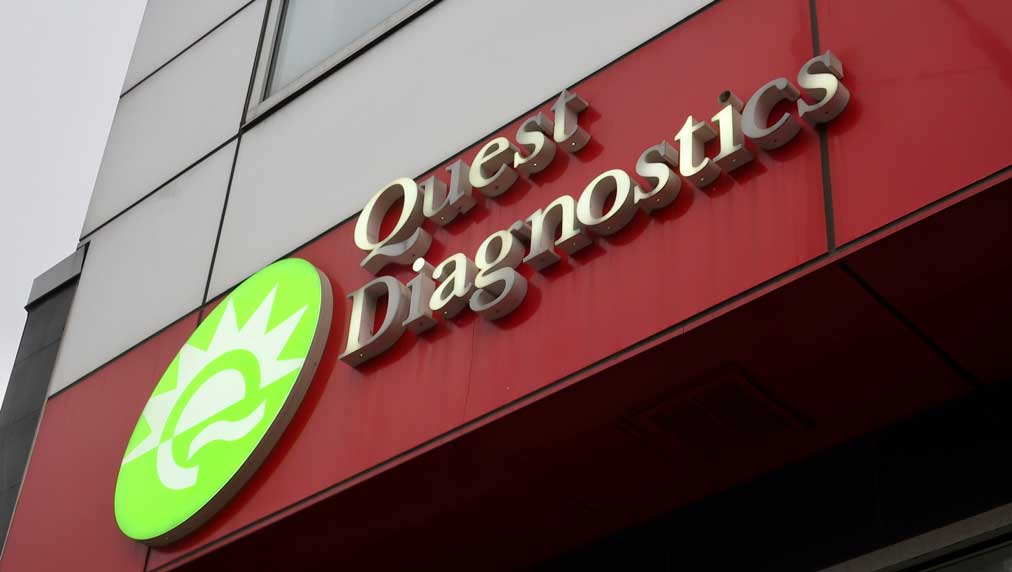 Quest Diagnostics پس از او و اورا-پیچ ضربان