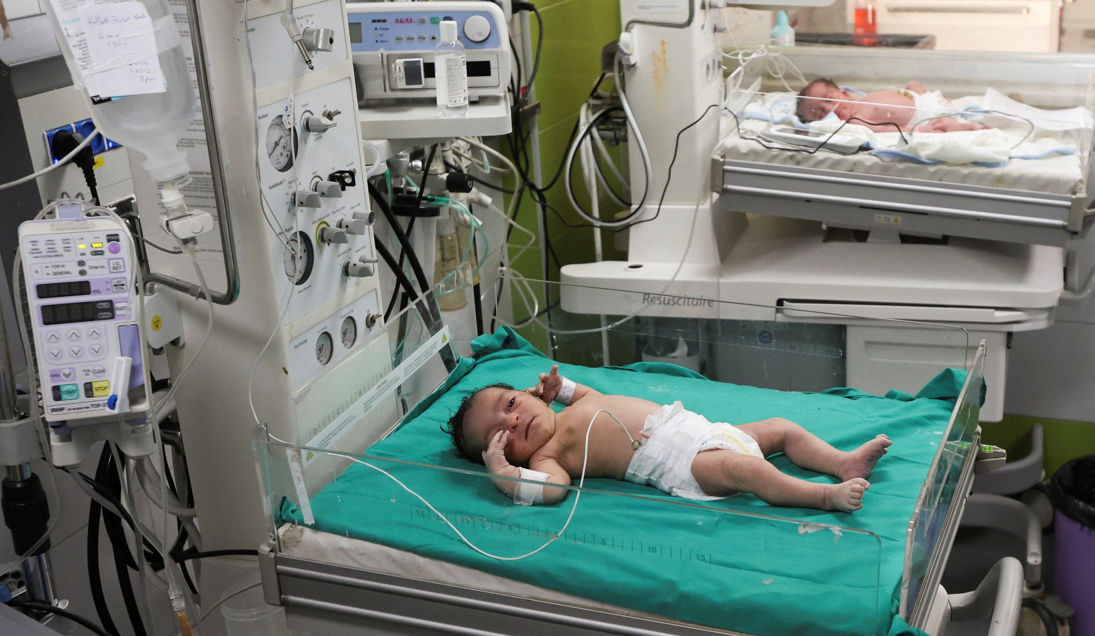 گزارش سازمان ملل نشان میدهد که میزان زاد و ولد غزه با سه برابر شدن سقط جنین در شش ماه