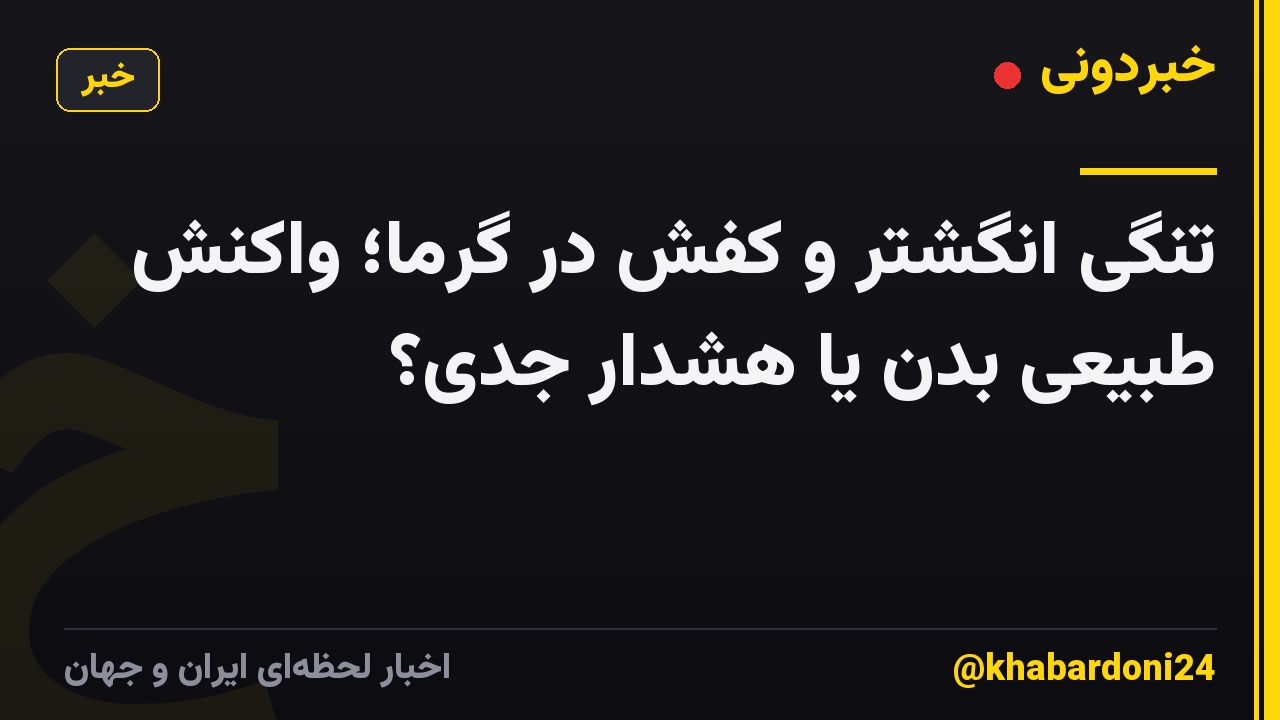 تنگی انگشتر و کفش در گرما؛ واکنش طبیعی بدن یا هشدار جدی؟