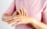 آیا واقعا میتوانیم جلوی نیش پشه را بگیریم؟