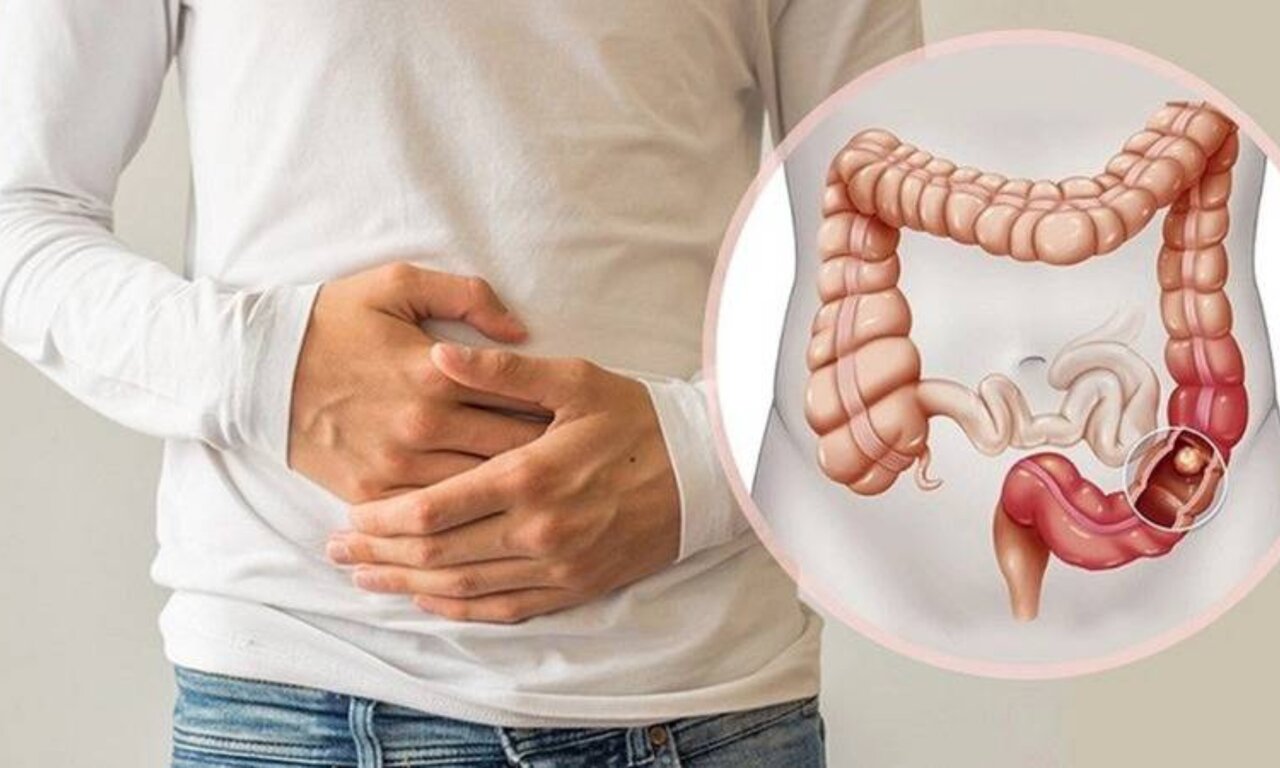 چرا بعضی یبوستها درمان سختتری دارند؟